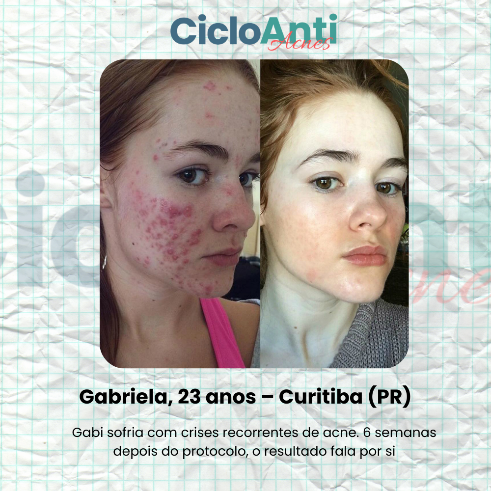 DEPOIMENTO 1 GABI